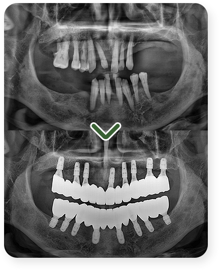 impl_case