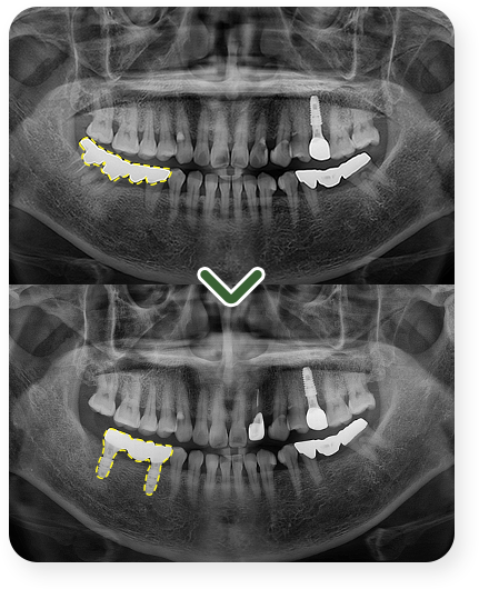 impl_case