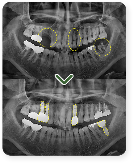 impl_case