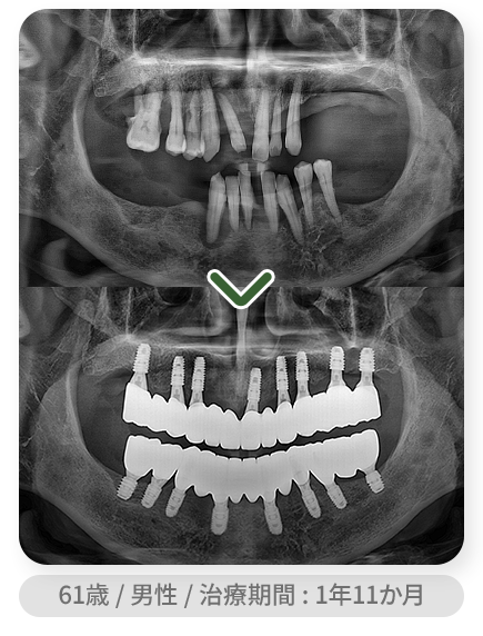 impl_case