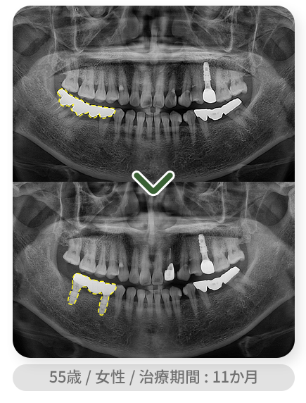 impl_case