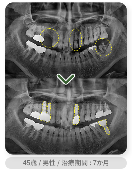 impl_case